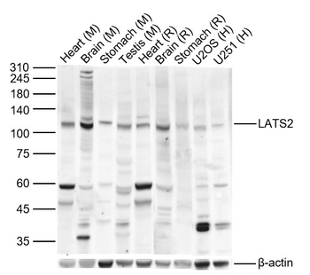 LATS2 Rabbit Polyclonal Antibody