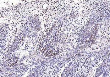Phospho-Lyn (Tyr397) Rabbit Polyclonal Antibody