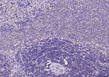 Phospho-Lyn (Tyr397) Rabbit Polyclonal Antibody