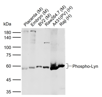 Phospho-Lyn (Tyr397) Rabbit Polyclonal Antibody