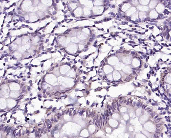 MAGEA4 Rabbit Polyclonal Antibody