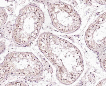 MAGEA4 Rabbit Polyclonal Antibody
