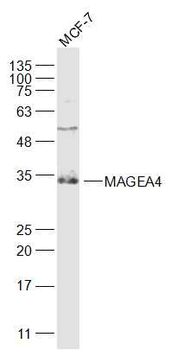 MAGEA4 Rabbit Polyclonal Antibody