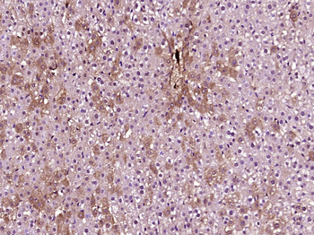 ME1 Rabbit Polyclonal Antibody