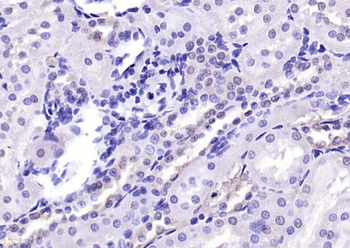 TORC2 Rabbit Polyclonal Antibody