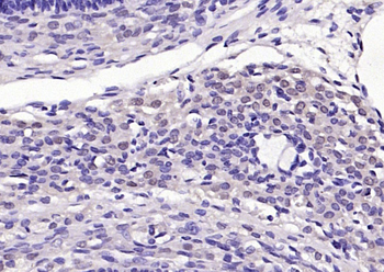 TORC2 Rabbit Polyclonal Antibody