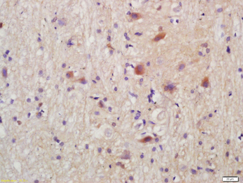 TORC2 Rabbit Polyclonal Antibody