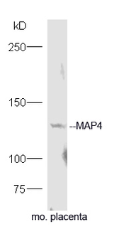 MAP4 Rabbit Polyclonal Antibody