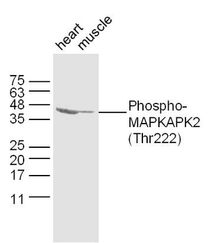 Phospho-MAPKAPK2 (Thr222) Rabbit Polyclonal Antibody