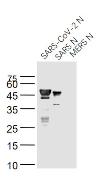 SARS-CoV Nucleocapsid Mouse Monoclonal Antibody