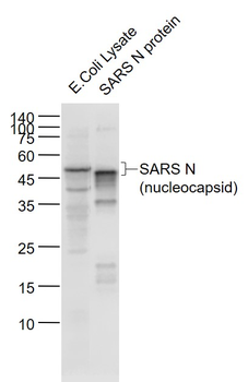 SARS-CoV Nucleocapsid Mouse Monoclonal Antibody