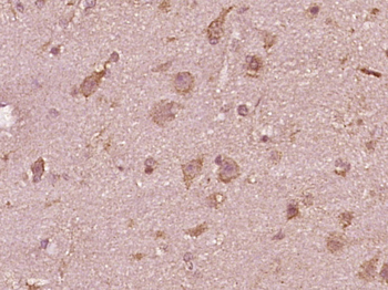 Phospho-ASK1 (Ser967) Rabbit Polyclonal Antibody