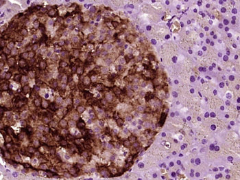 Phospho-ASK1 (Ser967) Rabbit Polyclonal Antibody
