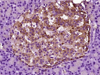 Phospho-ASK1 (Ser967) Rabbit Polyclonal Antibody