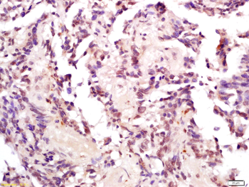 Phospho-MDM2 (Thr218) Rabbit Polyclonal Antibody