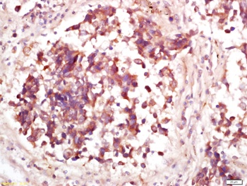 MDM2 (phospho-Thr218) antibody