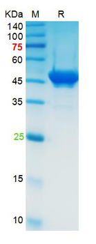 Recombinant SARS-Cov-2 N protein, N-His