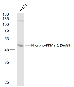 Phospho-PKMYT1 (Ser83) Rabbit Polyclonal Antibody