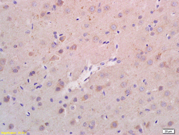 RHEB Rabbit Polyclonal Antibody