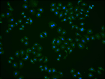 MST1 Rabbit Polyclonal Antibody