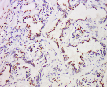 MST1 Rabbit Polyclonal Antibody