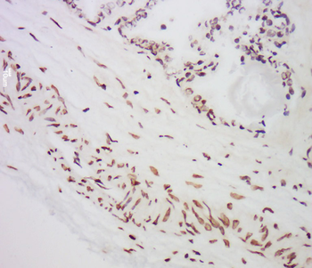 MST1 Rabbit Polyclonal Antibody