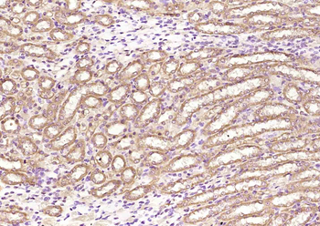 GTPBP3 Rabbit Polyclonal Antibody
