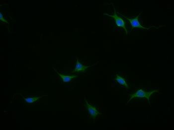 PMP2 Rabbit Polyclonal Antibody