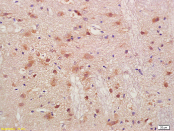 PMP2 Rabbit Polyclonal Antibody