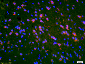 PMP2 Rabbit Polyclonal Antibody