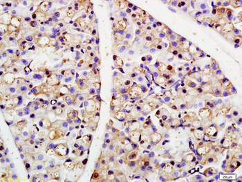 NCOA3 Rabbit Polyclonal Antibody