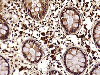 Phospho-NDRG1 (Thr346) Rabbit Polyclonal Antibody
