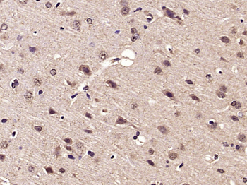 Phospho-NDRG1 (Thr346) Rabbit Polyclonal Antibody