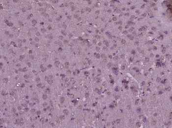 NDUFV1 Rabbit Polyclonal Antibody