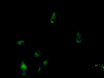 NDUFV2 Rabbit Polyclonal Antibody