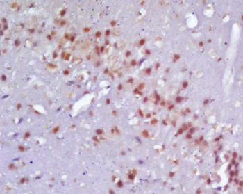 Neurogenin 2 Rabbit Polyclonal Antibody