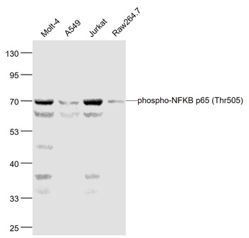 NFKB p65 (phospho-Thr505) antibody