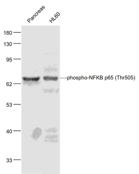 NFKB p65 (phospho-Thr505) antibody