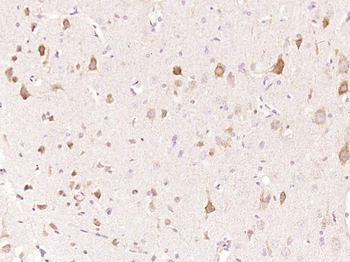 P53R2 Rabbit Polyclonal Antibody