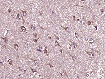 NNT Rabbit Polyclonal Antibody