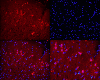 NOX2 Rabbit Polyclonal Antibody