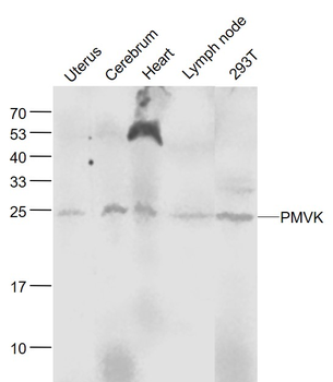PMVK Rabbit Polyclonal Antibody