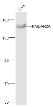 NMDAR2A Rabbit Polyclonal Antibody
