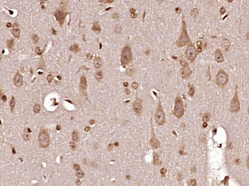 MT-ND6 Rabbit Polyclonal Antibody