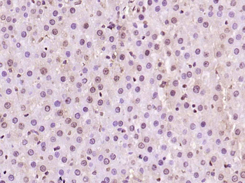 Nur77 Rabbit Polyclonal Antibody