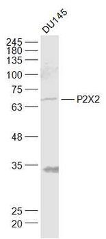 P2X2 Rabbit Polyclonal Antibody