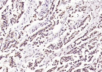 Phospho-CDKN1A/p21 (Thr145) Rabbit Polyclonal Antibody