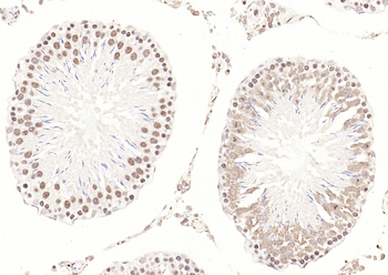 Phospho-CDKN1A/p21 (Thr145) Rabbit Polyclonal Antibody
