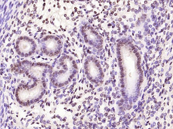 Phospho-CDKN1A/p21 (Thr57) Rabbit Polyclonal Antibody