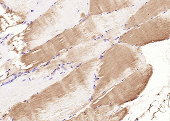 Phospho-CDKN1B (Thr157) Rabbit Polyclonal Antibody